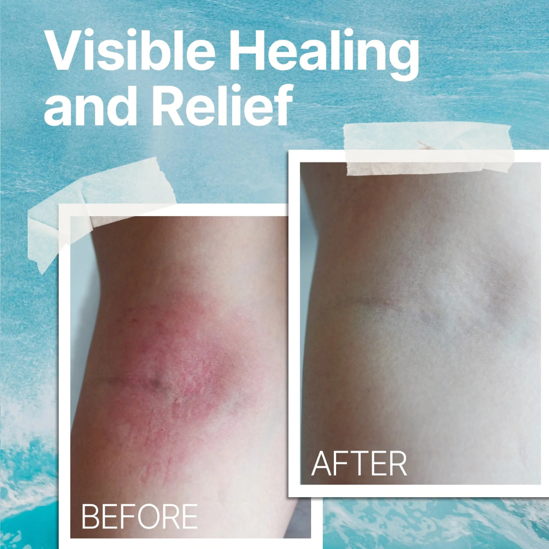 Natürliche beruhigende Creme